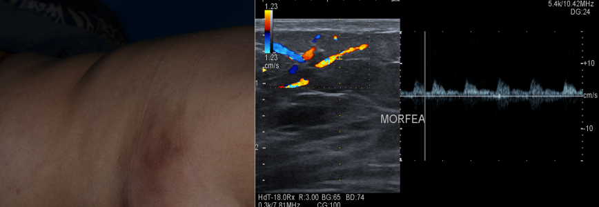 08a27b8d-446f-4dcb-8117-6b1875ff224a 08a27b8d-446f-4dcb-8117-6b1875ff224a