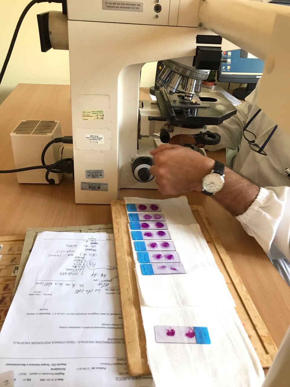 COLORAZIONE CON EMATOSSILINA EOSINA COLORAZIONE CON EMATOSSILINA EOSINA