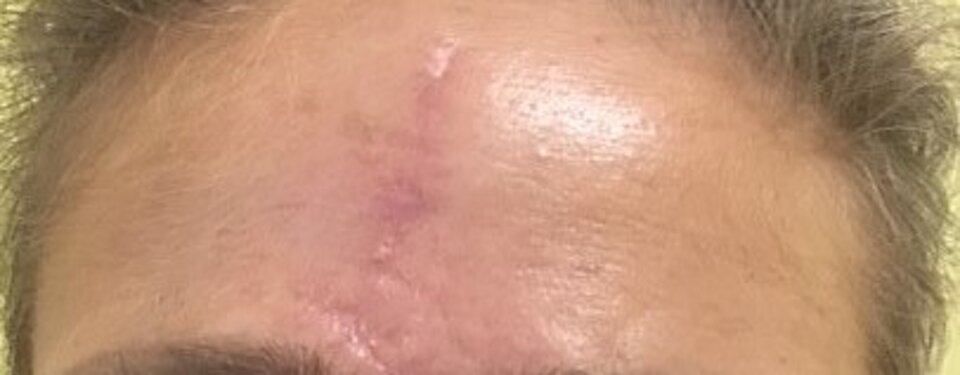 Controllo a 2 mesi Controllo a 2 mesi