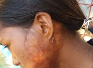 paziente2.jpeg paziente2.jpeg