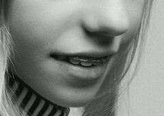 JTdCJTIyaXQlMjIlM0ElMjJUcmF0dGFtZW50byUyMG9ydG9kb250aWNvJTIwZSUyMGNvbnRyb2xsbyUyMGRlbGwlRTIlODAlOTlvY2NsdXNpb25lJTIwZGVudGFsZSUyMiU3RA== JTdCJTIyaXQlMjIlM0ElMjJUcmF0dGFtZW50byUyMG9ydG9kb250aWNvJTIwZSUyMGNvbnRyb2xsbyUyMGRlbGwlRTIlODAlOTlvY2NsdXNpb25lJTIwZGVudGFsZSUyMiU3RA==