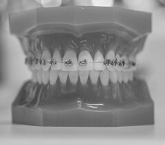 OSteopatia, Anatomia cranio-mandibolare e relazione tra occlusione, mandibola e articolazione temporo-mandibolare (ATM). OSteopatia, Anatomia cranio-mandibolare e relazione tra occlusione, mandibola e articolazione temporo-mandibolare (ATM).