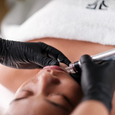 factoryspa-hydramethod-nanoneedling-3.jpeg