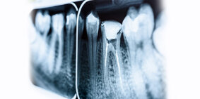 aso - endodonzia - copia.jpeg