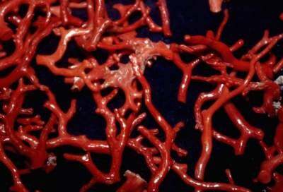 assortimento di rami di corallo allo stato lucido