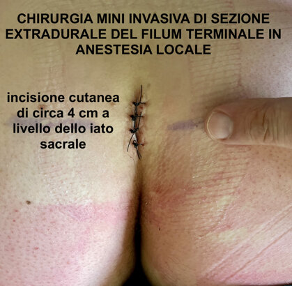 1cb75718-196f-4647-b0d9-4394060bbc96.jpeg 1cb75718-196f-4647-b0d9-4394060bbc96.jpeg