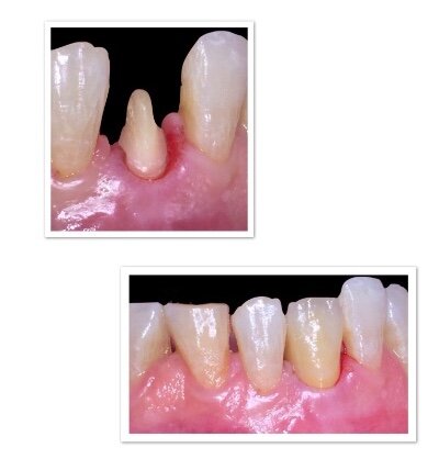 81a8ed5f-a131-4d05-b3d0-eab85a6ad618