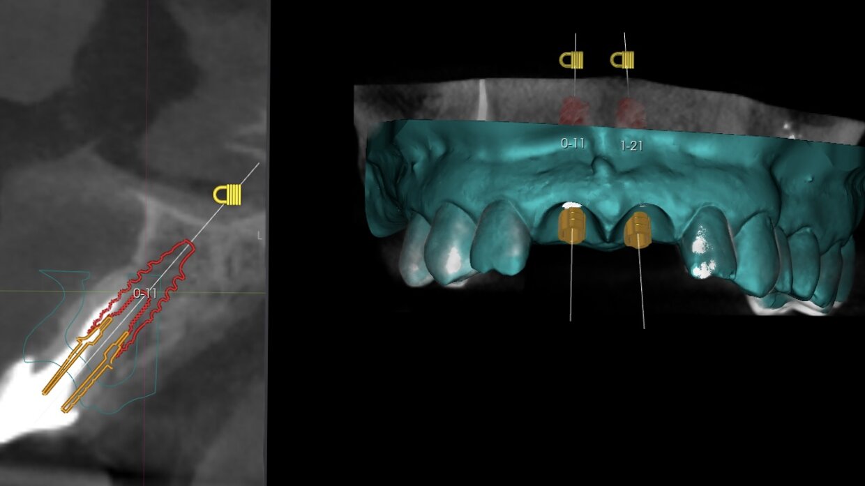 Dettaglio progettazione