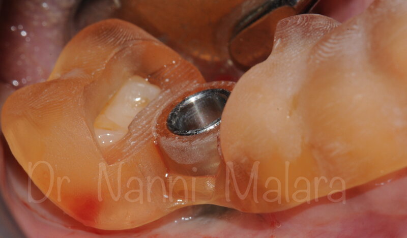 68ec618c-a7a1-4632-a361-7708eba2b54d