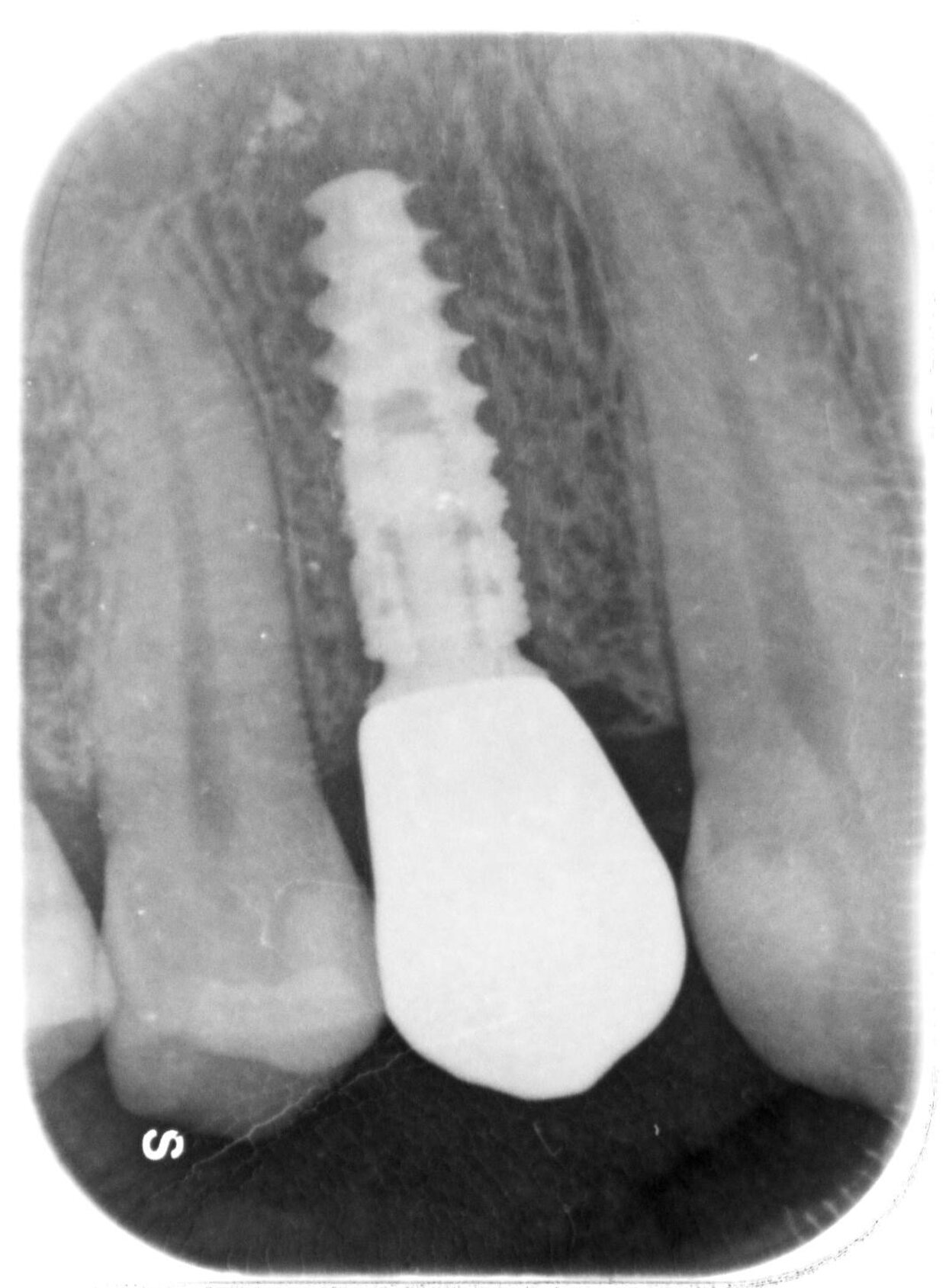 RX di controllo finale