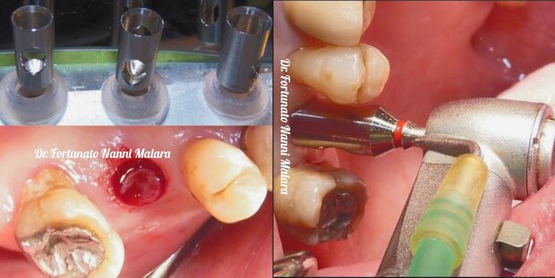 5a056dfc-3597-4f04-ba6b-0e5980a58125 5a056dfc-3597-4f04-ba6b-0e5980a58125