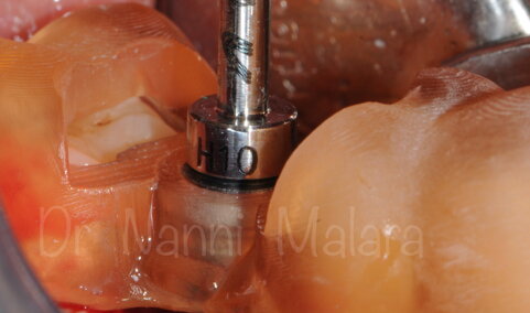 f536dd77-c085-4be1-b69f-1f295dd6b08a