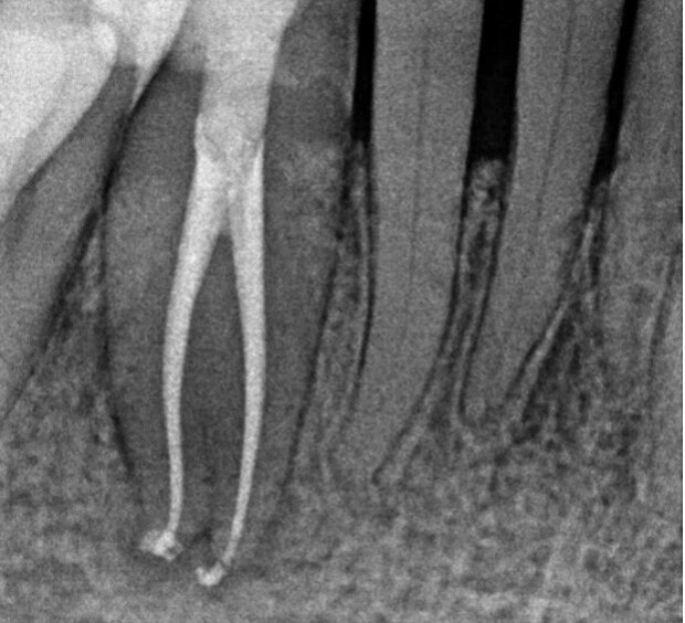 bb04b25b-221e-453d-9d13-620772f7c3f6 bb04b25b-221e-453d-9d13-620772f7c3f6