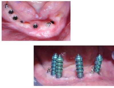 58535d8c-8ce2-46e2-aae4-c91e7af17bf6 58535d8c-8ce2-46e2-aae4-c91e7af17bf6