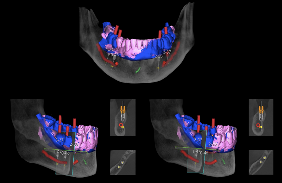 Progettazione computer guidata