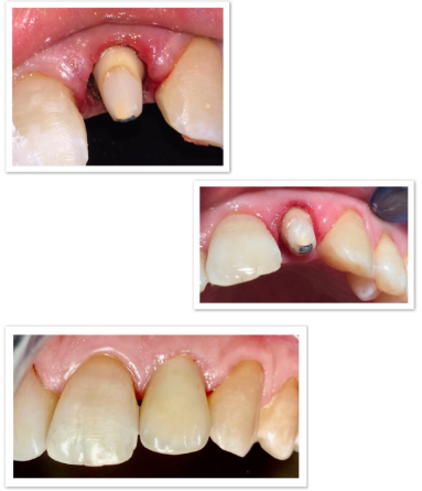 d2bbb3fc-9811-405b-9de3-304e9ffa69e4