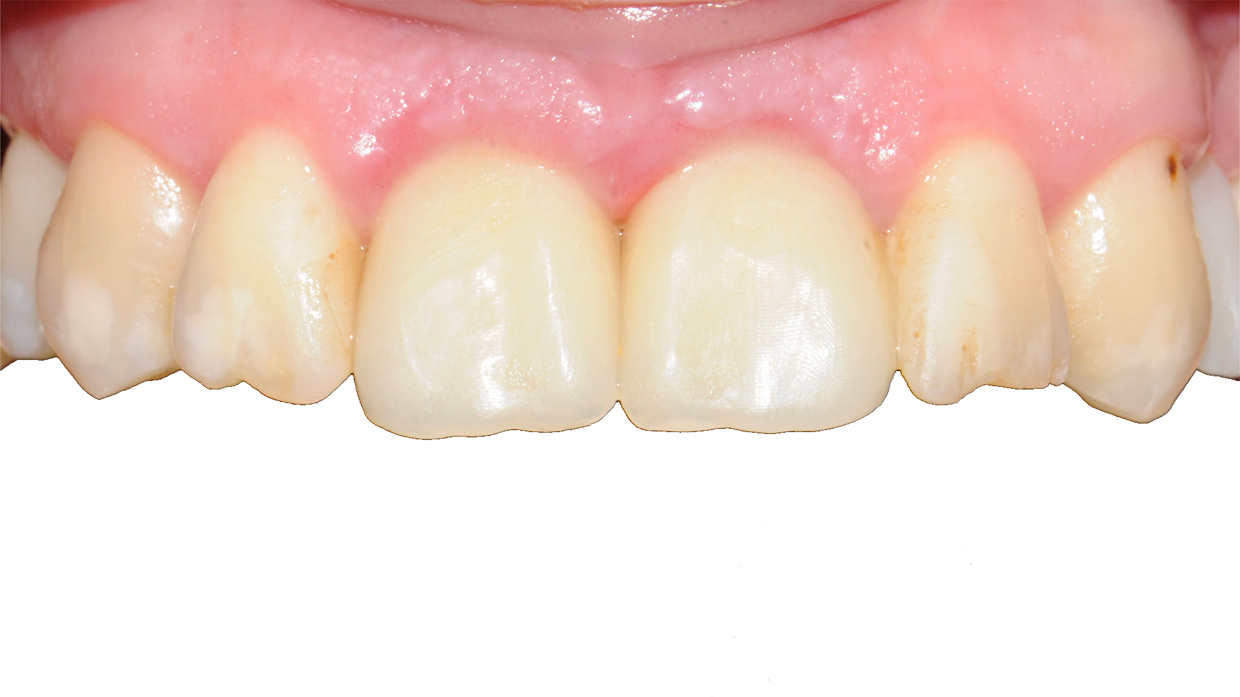 Controllo a distanza