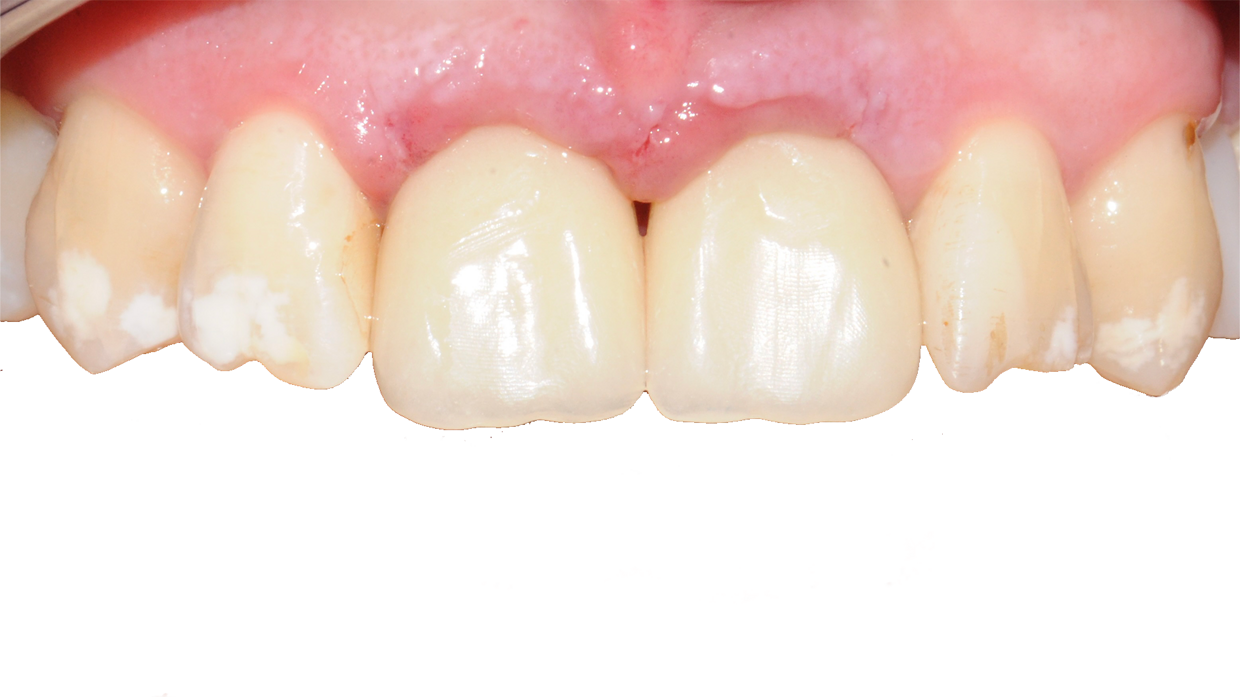 Consegna provvisori lo stesso giorno dell'intervento