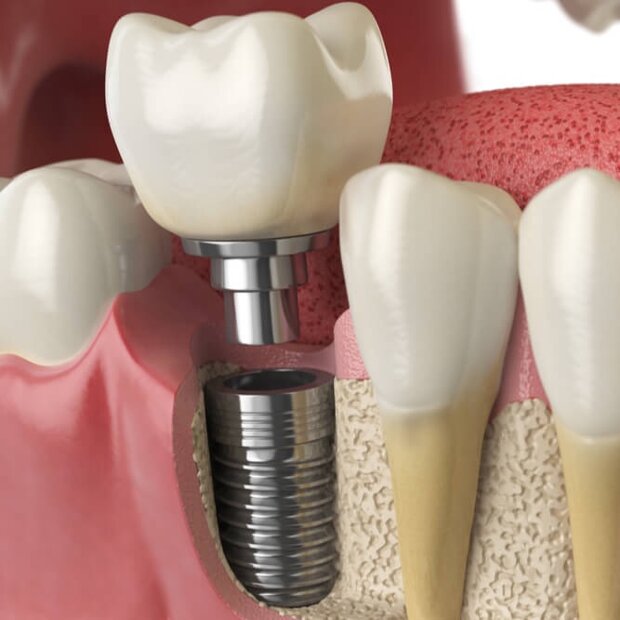 fc7f0e97-444f-40cc-9dd4-81b55049b368 fc7f0e97-444f-40cc-9dd4-81b55049b368