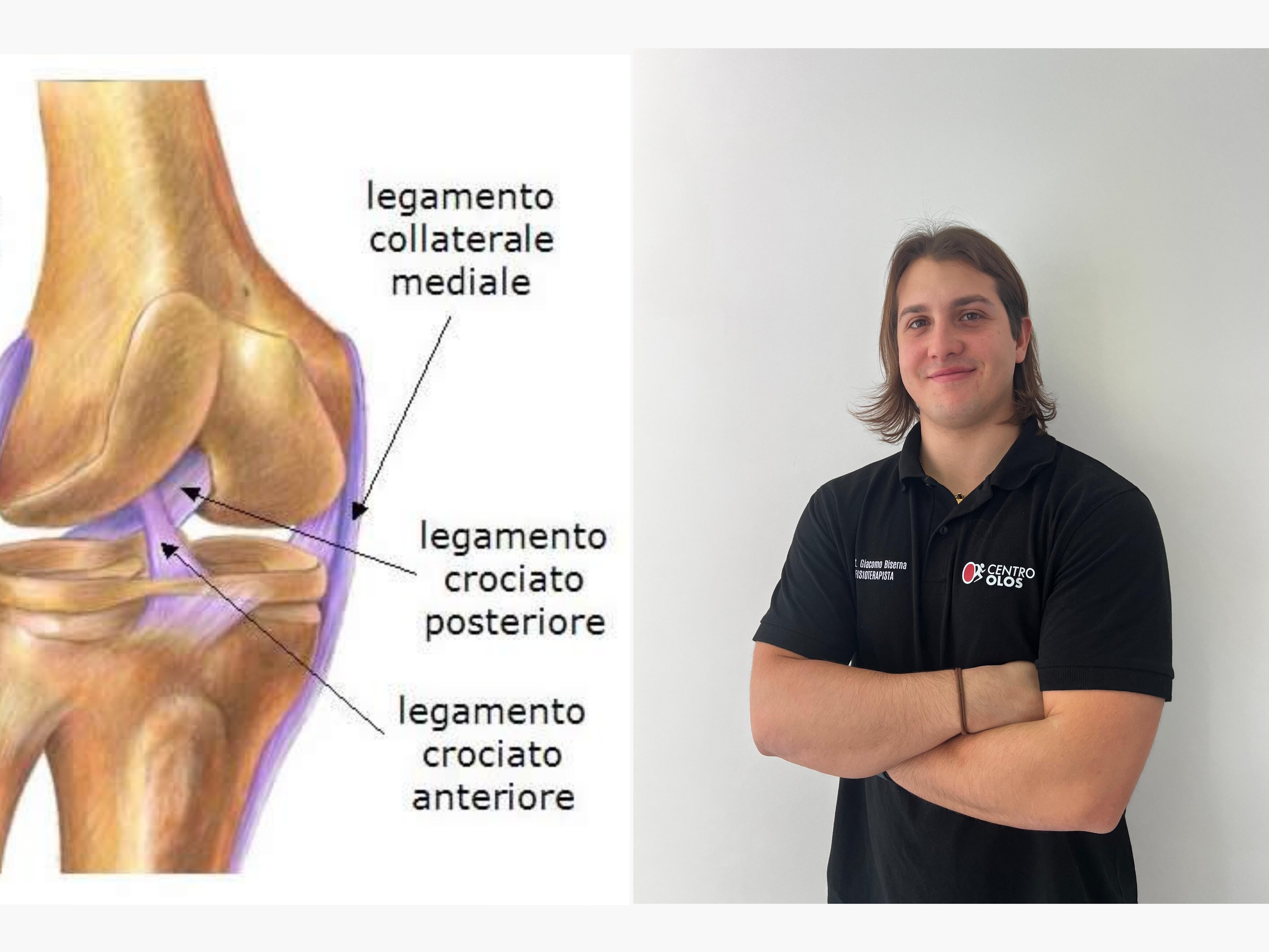 Lesione del LCA: chirurgia sì o chirurgia no? Lesione del LCA: chirurgia sì o chirurgia no?