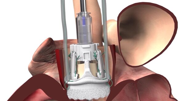 f01c8f7e-2675-447f-a8c2-d5bad7829261.jpeg f01c8f7e-2675-447f-a8c2-d5bad7829261.jpeg