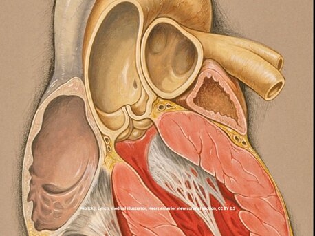 JTdCJTIyaXQlMjIlM0ElMjIlNUMlMjIlMjBWYWx2b2xhJTIwYW9ydGljYSUyMHNhbmElMjBjb24lMjB0cmUlMjBjdXNwaWRpJTIwc2VtaWx1bmFyaSUyMCVFMiU4MCU5MyUyMGFuYXRvbWlhJTIwY2FyZGlhY2EuLSUyMCUyMERyLiUyMEZhYnJpemlvJTIwQ29ydGklMkMlMjBjYXJkaW9jaGlydXJnbyUyMGElMjBNb256YSU1QyUyMiUyMiU3RA==