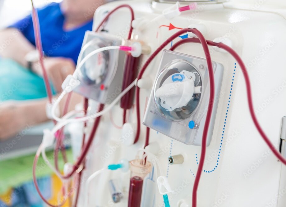 Dialisi attraverso chi l'ha vissuta! Dialisi attraverso chi l'ha vissuta!