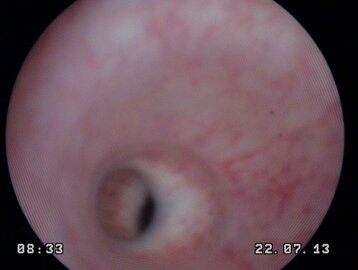 dfc47989-e5a1-4a88-ac32-63e0d9ac678a