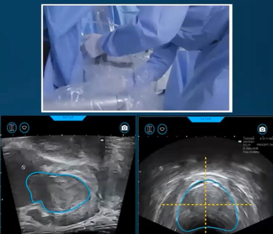 cb2baee7-d1f3-46f2-bf73-c0c448239261