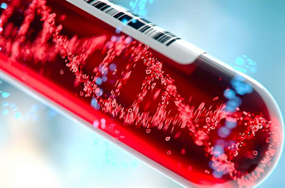 68dcdf53-cd2d-46c8-b3c5-3ddd4e0454df