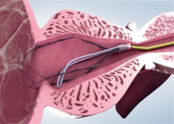 38b6c7f3-5635-42ea-a377-a4c6c5b235b6