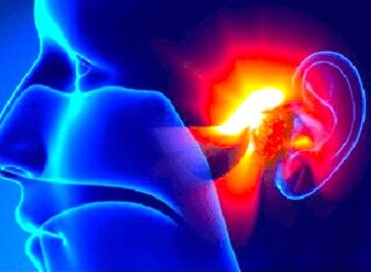 orecchio infiammato.jpeg