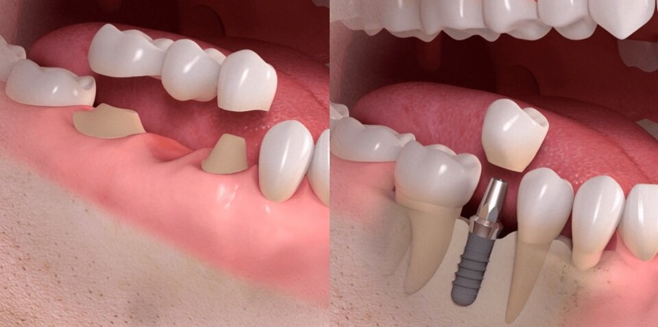 24a4f1dd-135d-42f4-ba9f-211157540a43.jpeg 24a4f1dd-135d-42f4-ba9f-211157540a43.jpeg