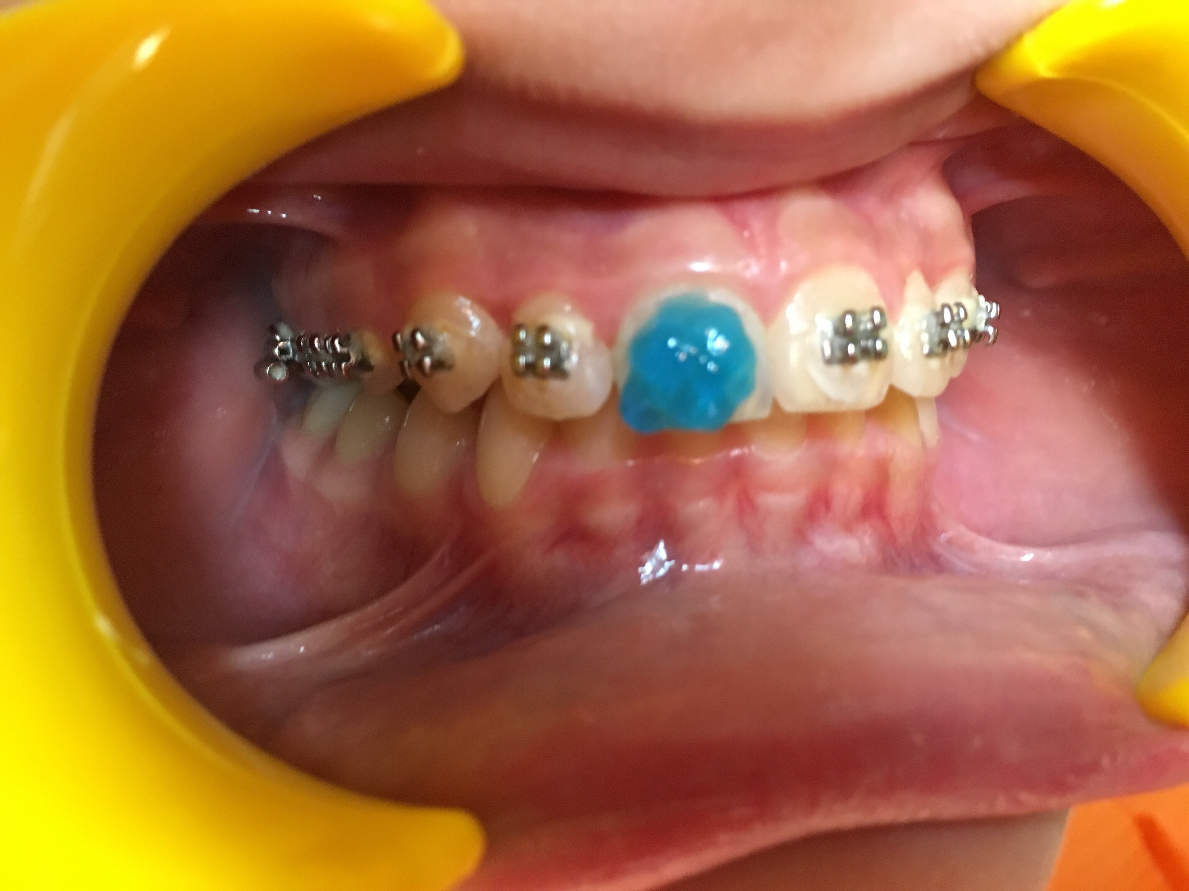 74b43830-652a-471a-9ab8-5a595d68bfc7.jpg 74b43830-652a-471a-9ab8-5a595d68bfc7.jpg