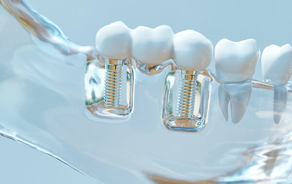 65782fc3-47bc-437f-b480-33e866c71e43.jpg 65782fc3-47bc-437f-b480-33e866c71e43.jpg