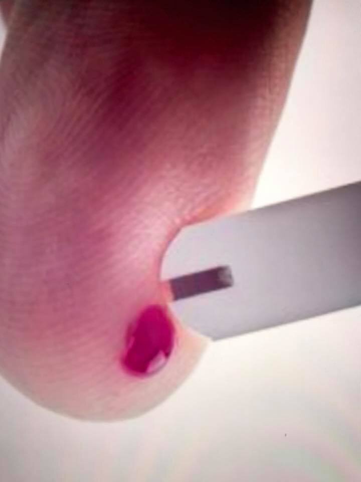 ... non solo denti ma anche Diabete ... non solo denti ma anche Diabete