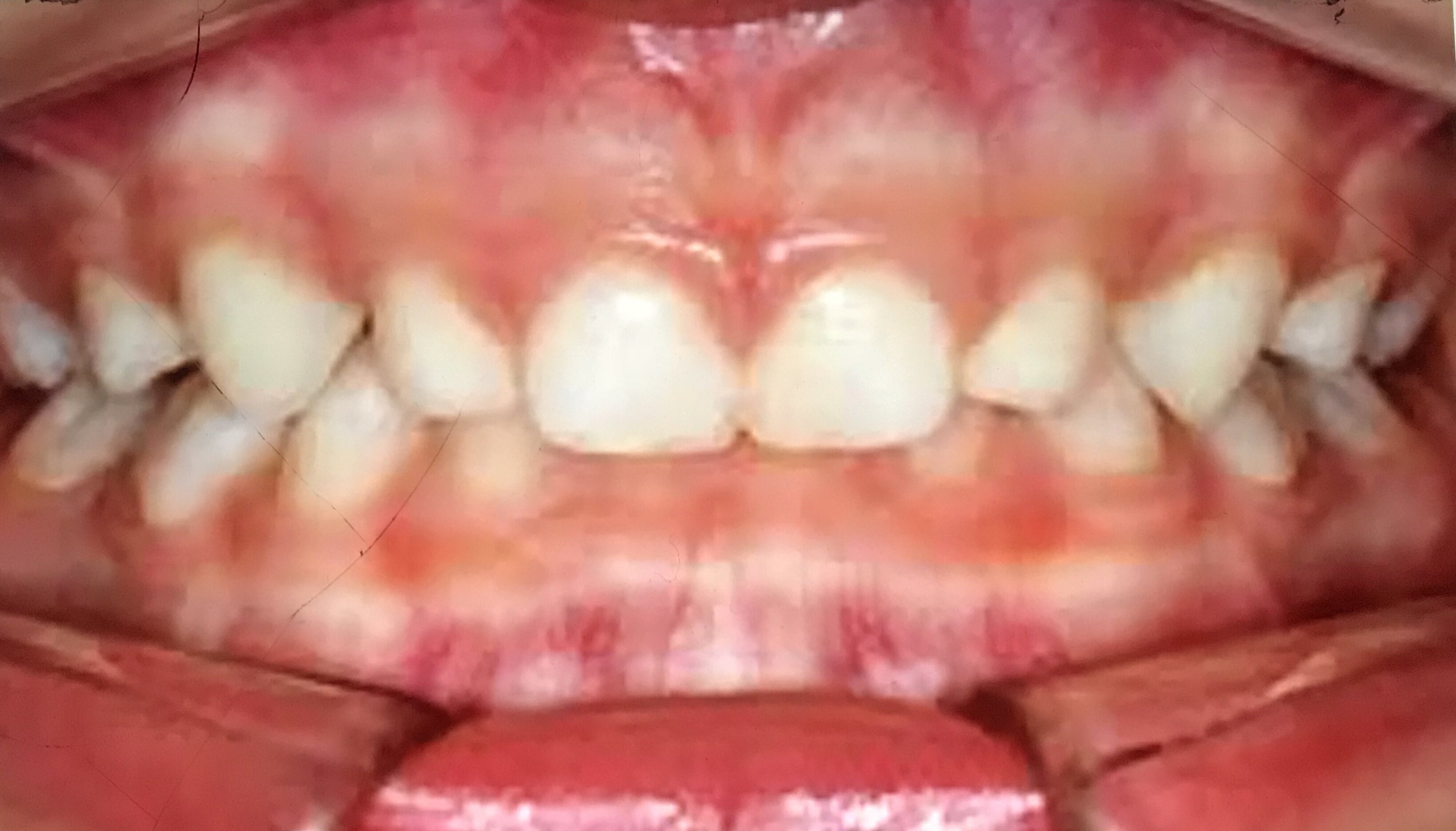 I DENTI DEI BAMBINI I DENTI DEI BAMBINI