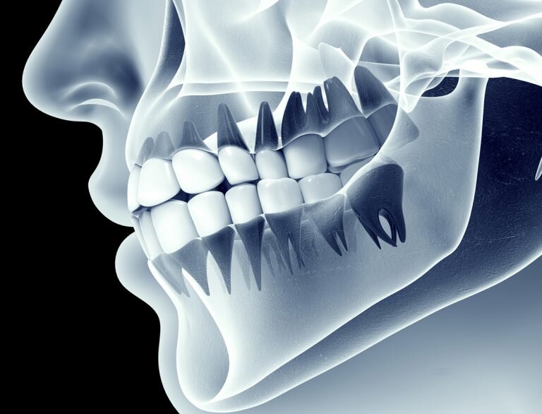 823ea490-eb90-4d4e-b2dc-b615c6aa246d.jpg 823ea490-eb90-4d4e-b2dc-b615c6aa246d.jpg