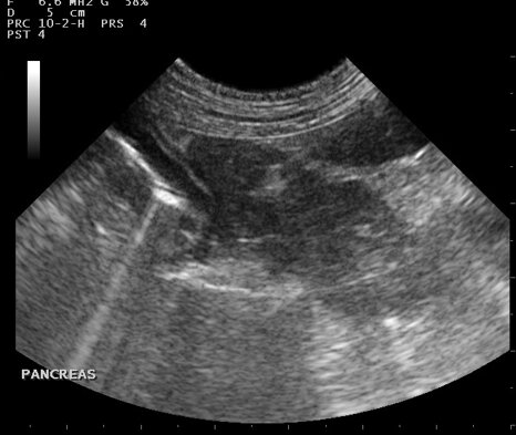 e2510371c600446481433b5b59804cca