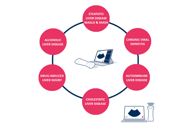 d504242e-45bb-4dad-b09b-2141eeb95051 d504242e-45bb-4dad-b09b-2141eeb95051