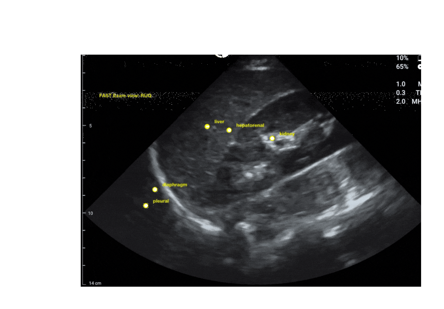 c444d683-57ac-436f-b7fe-7f2e5185b3b6