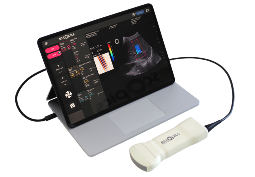 acaee45f-6ec3-4f8d-a2e1-187023822d10 acaee45f-6ec3-4f8d-a2e1-187023822d10