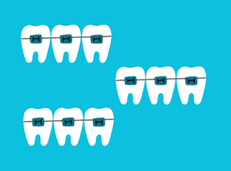 ortodonzia ortodonzia