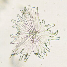 Pelo di ulivo Pelo (tricoma) pluricellulare di ulivo