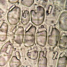 Stiloidi (cristallidi ossalato di calcio) in cellule di aglio Stiloidi (cristallidi ossalato di calcio) in cellule di aglio