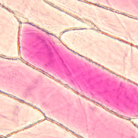 Cellule di cipolla con vacuolo pieno di antociani