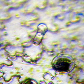 Pelo di ciclamino Pelo (tricoma) ghiandolare di ciclamino