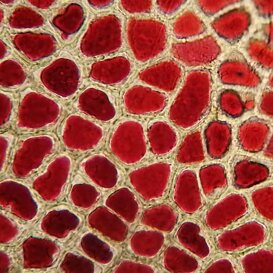 Cellule di susina con vacuolo colmo di antociani