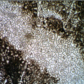 Cavolfiore (Brassica oleracea) Cellule e stomi di cavolfiore
