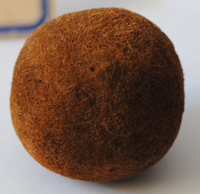 tricobezoar tricobezoar